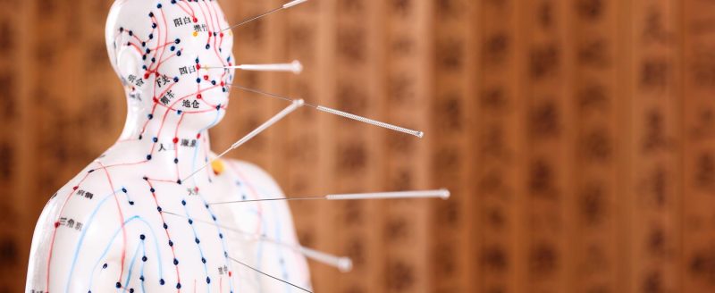 5 Scientists Weigh in on Acupuncture