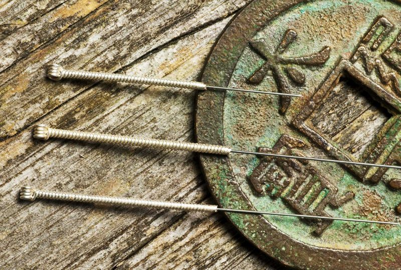 Acupuncture