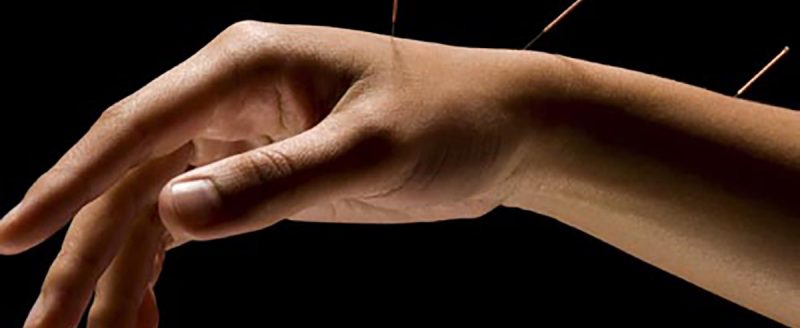 A Visual Guide to Acupuncture